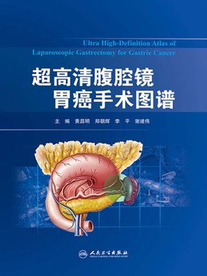 cover image of 超高清腹腔镜胃癌手术图谱